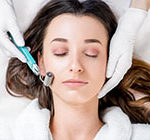 Microneedling - Puderdose Kosmetik Cottbus